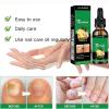 2Pcs Ginger Nail, Ginger Cuticle Care Oil For Nails, Ginger Serum Solution, Cuticle Serum For Nails view 4
