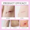 2pcs Silicone Scar Gel Scar Cream,Treats Old and New Scars,Stretch Marks Removal Formula Helps from Surgical, Burns, Acne Scar Treatment with,Non-Irritating Scar Removal Cream 60g/2.12oz view 2