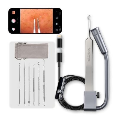 Luma 1 Visual Blackhead Remover Tweezers with Camera - Pimple Popper Tool with Camera 20x Magnification, 1080P, 8 LED Lights, with Blackhead Remover Pimple Popper Tool Kit (6 Piece Kit),Gray Blue