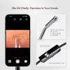 Luma 1 Visual Blackhead Remover Tweezers with Camera - Pimple Popper Tool with Camera 20x Magnification, 1080P, 8 LED Lights, with Blackhead Remover Pimple Popper Tool Kit (6 Piece Kit),Gray Blue view 4