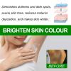 2PCS Private Parts Whiten Cream,Body Whitening Cream, Fast Bleach Private Parts Lighten Underarm Legs Knees Melanin view 4