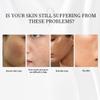 2% Alpha Arbutin Serum for Face - Dark Spot Corrector & Hydrating Brightening Essence, Fades Hyperpigmentation, Evens Skin Tone, for All Skin Types 2 fl oz view 3