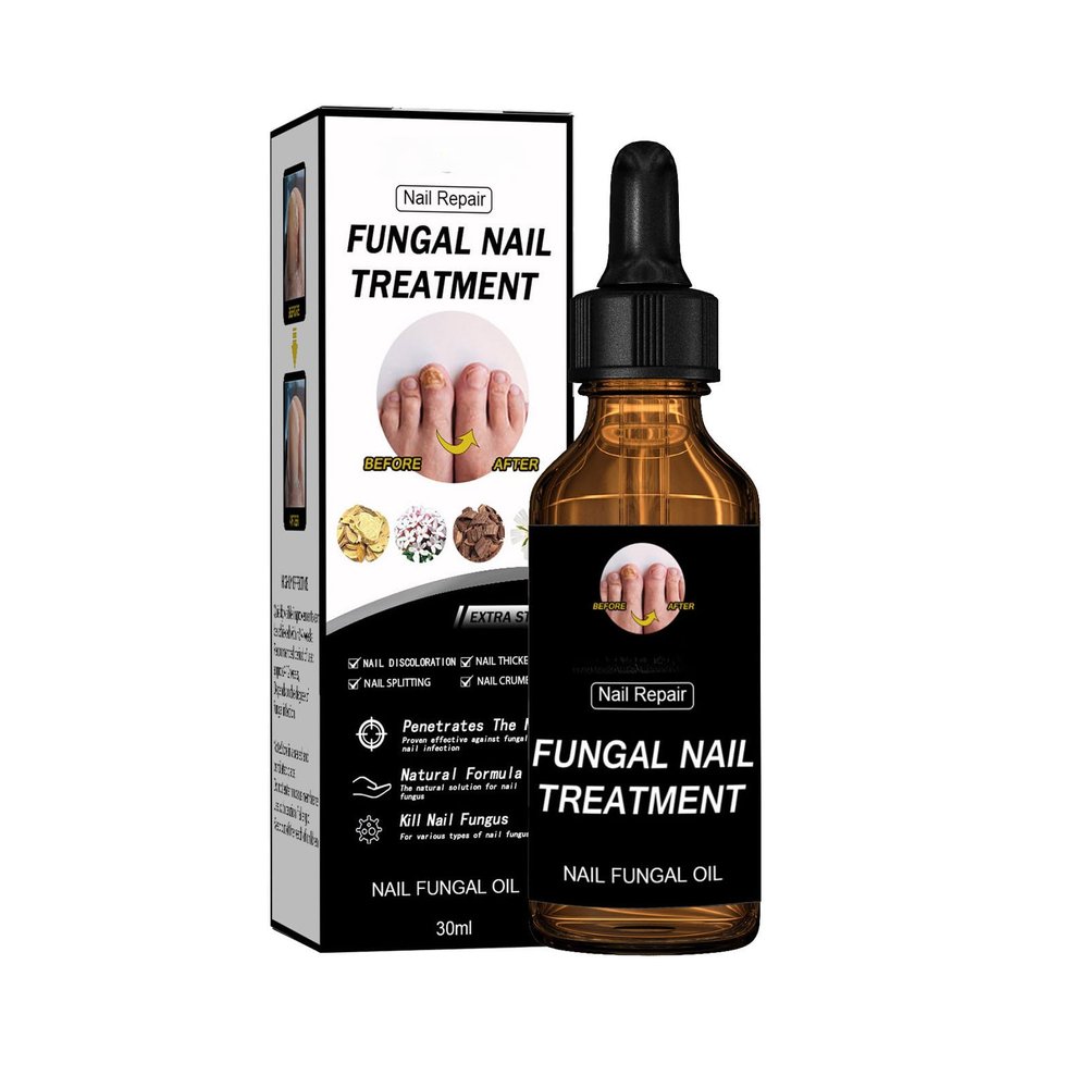 Fungal Nail Treatment Repairs Nail Discoloration and Thickness, nail fungus treatment extra strength 30ml 2PCS