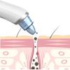 EZAGMWGFB Electric Blackhead and Comedone Extractor Tools with Camera Skin Pore Cleaner Vacuum for Women & Men view 2
