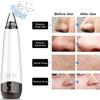 EZAGMWGFB Blackhead Remover Pore Vacuum Facial Cleaner Electric Acne Extractor USB Rechargeable Comedo Removal Beauty Device with 6 Suction Head 3 Adjustable Level Portable view 3