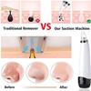 EZAGMWGFB Blackhead Remover Pore Vacuum Facial Cleaner Electric Acne Extractor USB Rechargeable Comedo Removal Beauty Device with 6 Suction Head 3 Adjustable Level Portable view 4