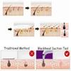 EZAGMWGFB Blackhead Remover Pore Vacuum Cleaner Acne Comedo Extractor USB Rechargeable Suction Tool with 4 Probes for Whitehead RemovalSafe, Effective, Painless view 2