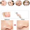 EZAGMWGFB Cleaner Acne Comedo Extractor USB Rechargeable Black Heads Removal Tool with 4 Probes for Facial SkinSafe, Effective, Painless, Portable and Easy to use view 2