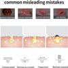 EZAGMWGFB Pimple Sucker Pore Cleaner USB Blackhead Remover Energy-Saving and Silent view 4