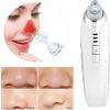 EZAGMWGFB Blackhead Removal Tool Vacuum,USB Rechargeable Face Acne Comedone Extractor Pore Cleanser Suction with 4 Probes & 5 Level view 3