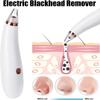 EZAGMWGFB Pore Vacuum with 3 Replaceable Suction Probes, Blackhead Cleaner Electric Acne Extractor view 4