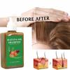 Batama Oil Shampoo,300ml Batana Oil Shampoo with Rosemary Extract for Hair Growth,Shampoos De Batana Para La Caida Del Cabello,Moisturizes and Strengthen Scalp,Reduces Hair Loss (2pcs) view 2