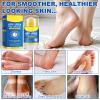 60% Urea Foot Cream, 1.41Fl Oz Foot Cream Maximum Strength Moisturizer for Dry Cracked Heels, Urea Foot Lotion Nourish Cracking Rough Dry Hands/Feet, Feet Callus Remover (2Pack) view 3