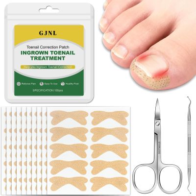 Ingrown Toenail Treatment,100 Pcs Breathable Ingrown Toenail Strips-Toenail Lifter and Small Scissors, Painless Ingrown Toenail Tool, Professional Pedicure for Ingrown Toenail, Toenail Corrector Patch