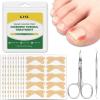 Ingrown Toenail Treatment,100 Pcs Breathable Ingrown Toenail Strips-Toenail Lifter and Small Scissors, Painless Ingrown Toenail Tool, Professional Pedicure for Ingrown Toenail, Toenail Corrector Patch view 1