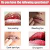 2PCS Lip Serum by Vitamin Extract, Lip Lightening for Dark Lips, Lip Balm Dark Lip Treatment for for Smokers and Non-smokers, Lip Brightener for Dark Lips Fade Cream view 4