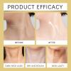 BERALLOYE Firming Neck Cream for Crepey Skin Body Care Comfort, Contains Hexapeptide, Moisturizing, Tightening Lotions Cosmetic Skin Care Skin Repair view 3