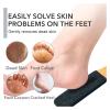 1PCS Professional Pedicure Rasp Tool for Dead Skin Crack Heels Beech Wood Foot File Rasp Callus Remover Foot Scrubber view 3