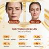 Peel Shot Glow Rice Ampoule Duo  White and Black Rice Exfoliating Ampoules, Pore Minimizing Gentle Peel, Deep Hydration - Christmas Gifts for All Skin view 4