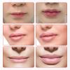 Lip Plumper Device for Fuller Lips - 1pc Cute Fish Mouth Shaped Silicone Lip Plumping Tool Sexy Lip Mouth view 4