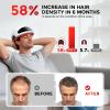 OVEKPA Red Light Therapy for Hair Growth Laser Cap - FDA Cleared Laser Therapy Device - Promotes Hair Regrowth Alopecia Treatment for Men & Women view 4