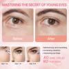 Instant Reduction of Eye Bags -Retinol Eye Cream Dark Circles,Bags Under Eyes,Eye Repair Cream AntiAging Moisturizer,retinol,Under Eve Care Creams Suit Women Men EyeFirm Smooth fimming eye-0.7 OZ-EEE view 4