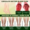 LHBMET Professional Leg Circulation CreamFluid Ease Leg Soothing CreamEdema Relief for Legs and FeetEffectively reduce leg discomfort (1PC) view 2