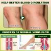 LHBMET Professional Leg Circulation CreamFluid Ease Leg Soothing CreamEdema Relief for Legs and FeetEffectively reduce leg discomfort (1PC) view 4