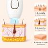 Blarie Glokore - Hair Remover, Permanent Hair Reduction, Gentle & Painless, Custom Comfort, Full-Body Coverage, Portable & Compact, Corded Power Supply view 4