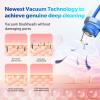 Blackhead Remover Pore Vacuum Upgraded Facial Pore Cleaner Electric Comedone Whitehead Extractor Tool-5 Suction Power,5 Probes,USB Rechargeable view 3