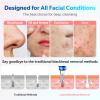 Blackhead Remover Pore Vacuum Upgraded Facial Pore Cleaner Electric Comedone Whitehead Extractor Tool-5 Suction Power,5 Probes,USB Rechargeable view 4
