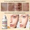 2PCS Rice Exfoliating Ampoule Set,White & Black Rice Facial Exfoliating Serum,Peel Shot Glow Rice Ampoule Duo,Gentle Peel & Deep Hydration,Facial Exfoliator,Pore Refining, Dead Skin Cells Remover view 4
