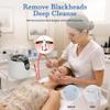 UNOISETION 3-in-1 Microdermabrasion Machine for Estheticians, Salon Diamond view 3