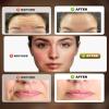 New Facial Massager Tool, Microcurrent Facial Device with Suction Shot, 4 Color Red Light Therapy, Face Massager Tool for Skin Care, Double Chin, Wrinkle Reduction and Firming, Portable Face Device view 4