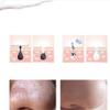 HCUCTOS Electric Pore Cleaner Blackhead Acne Extractor USB Rechargeable Display for Facial Skin Suitable for Family, Travel use view 3