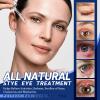 Stye Eye Treatment, Chalazion Treatment Serum, Stye & Blepharitis Remover with Hippophae Rhamnoides Fruit, Helichrysum Angustifolium Flower & Persea Gratissima Oil (1 Fl. OZ (Pack of 1)) view 2