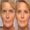 Retinol Gel 0.1 Vitamin A Repairs Fine Lines & Wrinkles, Scar Treatment, Age and Sun Spots, Anti-Aging Formula Gel 20 Grams view 4