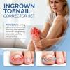 Ingrown Toenail Corrector Set with Correction Strips, Professional Ingrown Toenail Removal Kit Pedicure Tool Set, In Grown Toe Nail Remover Curve Tape at Home for Men Women view 2