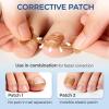 Ingrown Toenail Corrector Set with Correction Strips, Professional Ingrown Toenail Removal Kit Pedicure Tool Set, In Grown Toe Nail Remover Curve Tape at Home for Men Women view 3