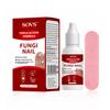 SOVS Toenail Treatment,Gentle Formula, Effectively Improves Nails for a More Beautiful Appearance (1Pcs, 1 oz) view 1