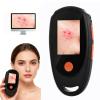 Beauty Star Dermatoscope for Skin 500 Magnification, Handheld Digital Scalp & Skin Camera, Wireless Portable Microscope for Skin & Scalp Analyzer, Rechargeable HD Trichoscope with 8 LED Lights view 1