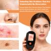 Beauty Star Dermatoscope for Skin 500 Magnification, Handheld Digital Scalp & Skin Camera, Wireless Portable Microscope for Skin & Scalp Analyzer, Rechargeable HD Trichoscope with 8 LED Lights view 2