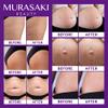 Stretch Mark Cream Prevention for Pregnancy - Maternity Cream for Stretch Marks Removal | Nourishing Formula  Prevents Stretch Marks & Improves Elasticity - 4 oz (120g) (4 oz (120g)) view 3