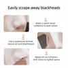5PCS Stainless Steel Blackhead Scraper, Face Skin Oil Remover Tool, Pore Deep Cleansing Tool, for Closed Comedones On T-Zone, Nose Wings, Chin, Forehead, Tiny Oil Particles on Shoulders Back view 4