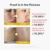medicube Peel Shot with Kojic Acid Turmeric for Troubled Skin view 4