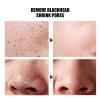 Facial Care Nature Silk Balls - Gentle Soft Exfoliating SilkWorm Balls Skin Scrub Cotton for Face, 30Pcs / Bottle view 2