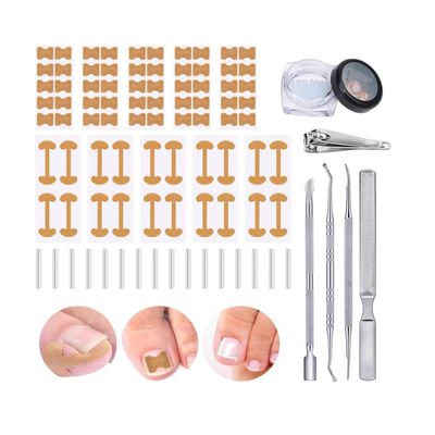 Ingrown Toenail Corrector Set with Correction Strips,Curved Toenails Corrector Patch, Painless File and Lifter Pedicure Tools for Women Man
