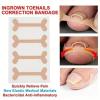 Ingrown Toenail Corrector Set with Correction Strips,Curved Toenails Corrector Patch, Painless File and Lifter Pedicure Tools for Women Man view 2