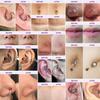 Keloid Bump Gel, Scar Prevention, Skin Renewal, Advanced Silicone Keloid Cream for Piercing Bumps 0.71 oz (1 Pack) view 2
