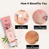Dark Spot, Scar Cream For Face, Acne Scars Cream For Women & Men (20 gm) view 3